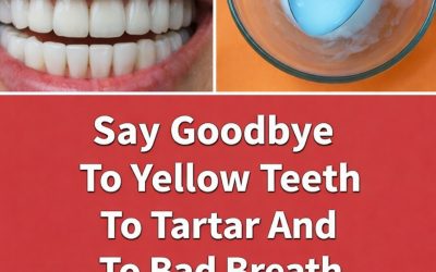 Say Goodbye to Yellow Teeth, Tartar, and Bad Breath With Only 2 Simple Ingredients