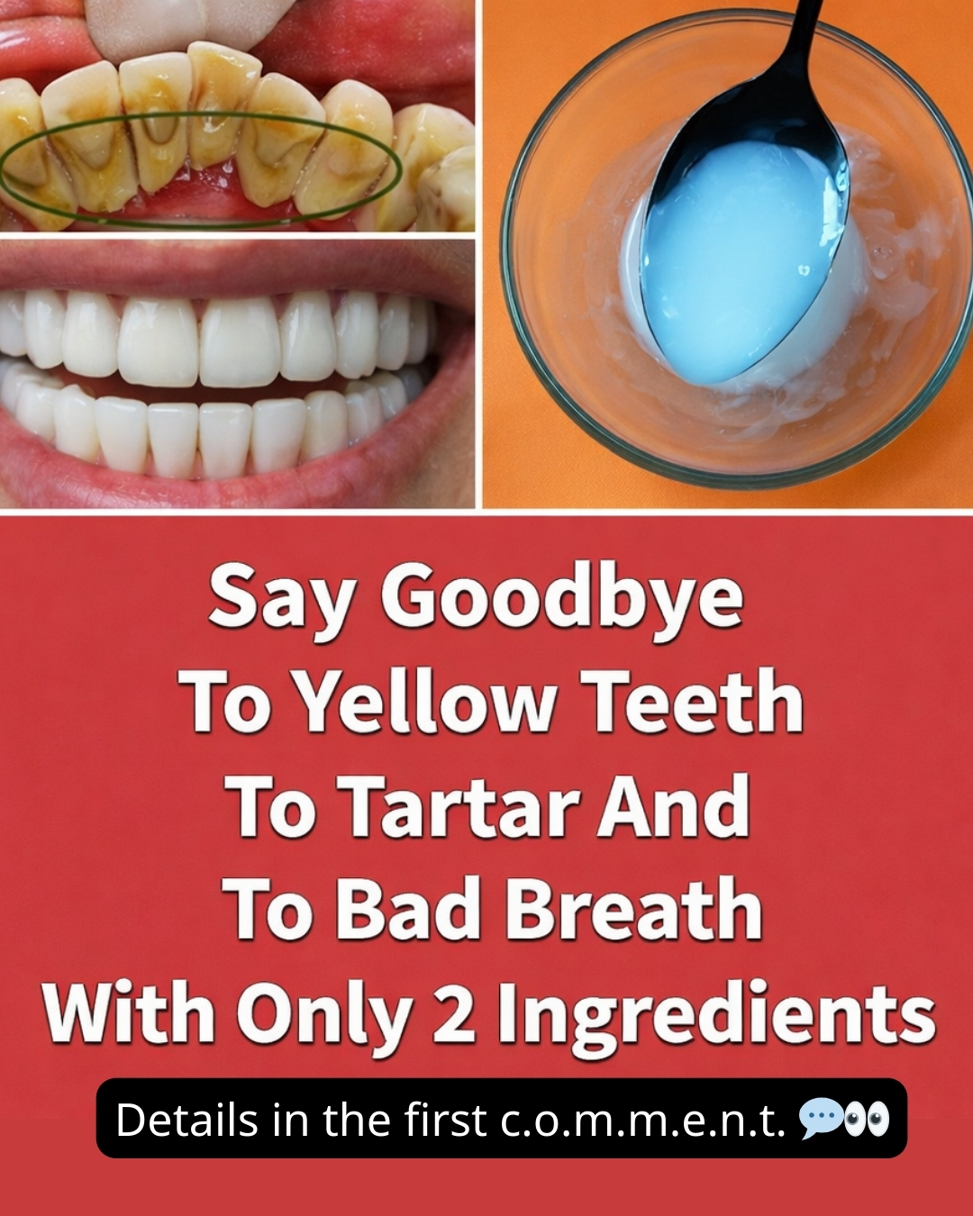 Say Goodbye to Yellow Teeth, Tartar, and Bad Breath With Only 2 Simple Ingredients