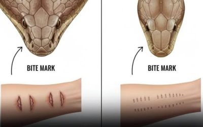 What to Do After a Snakebite: Essential First Aid Steps That Can Make a Difference