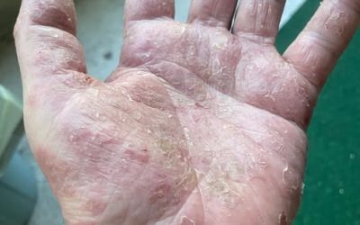 These are the signs that it’s growing…See more