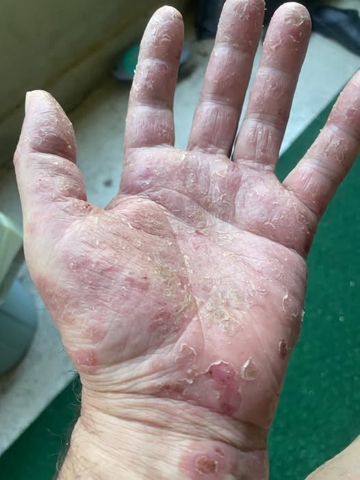 These are the signs that it’s growing…See more