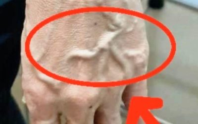 If you have visible veins, it means you are… See more
