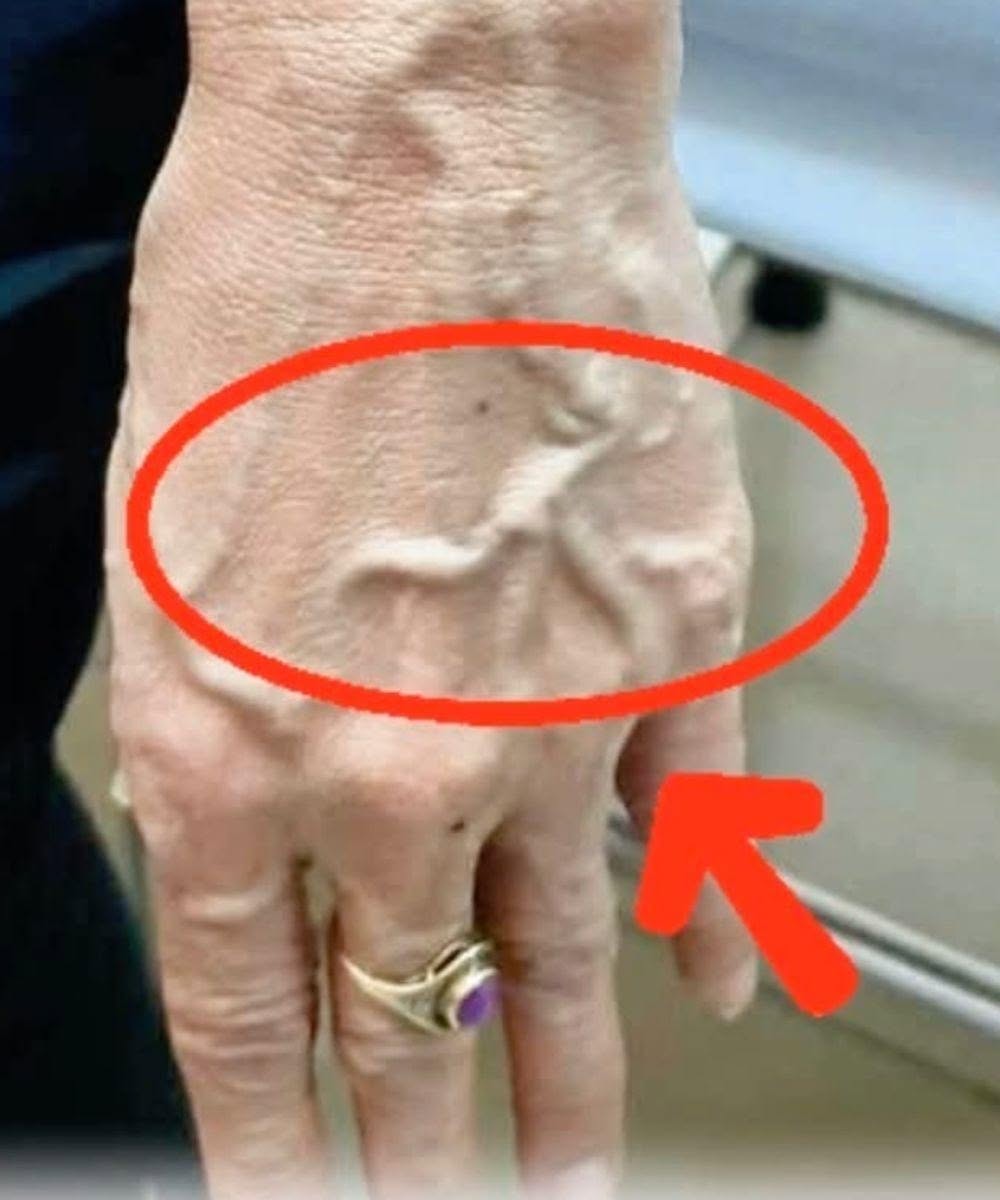 If you have visible veins, it means you are… See moreIf you have visible veins, it means you are… See more