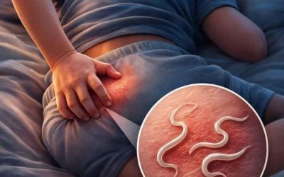 Pinworms in Children: What They Are and Why They Cause Nighttime Itching.