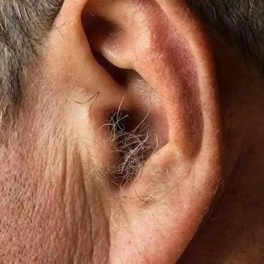 DID YOU KNOW? If hair grows on your ears, it’s because your body is…see more