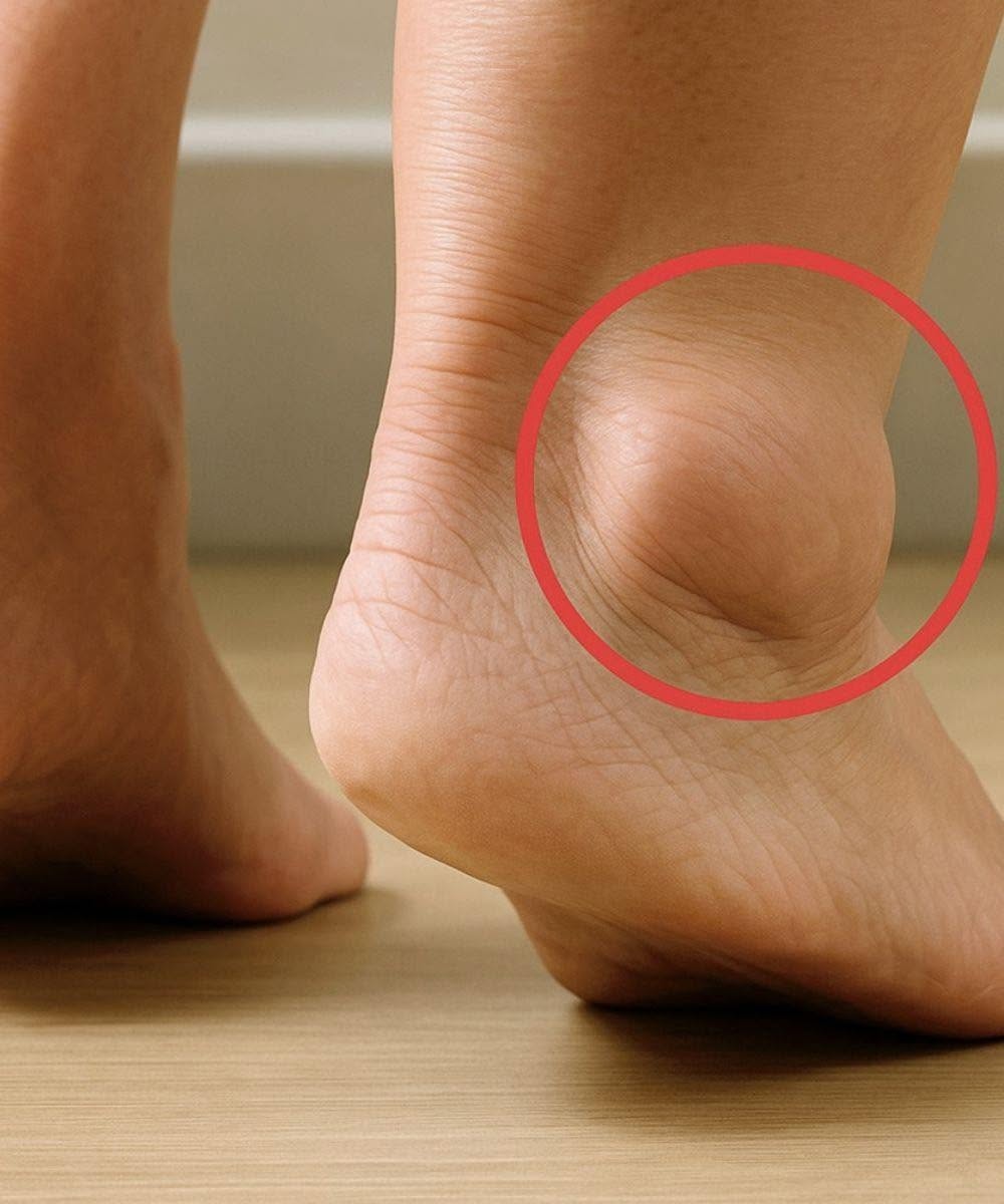 If you notice your legs are swollen, that’s a sign of ca…See more in 1st comment 👇👇