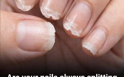 Brittle or fragile nails: what your body is trying to tell you