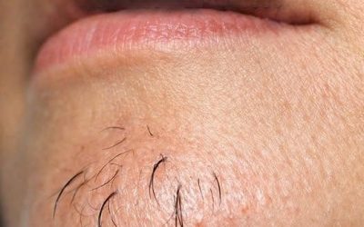 A woman’s chin hair is a sign of…See more