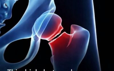 The five drinks that are most harmful to your bones, according to health experts.