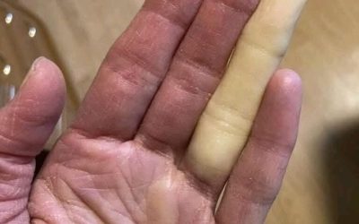 These are the consequences of sleeping with the… See more