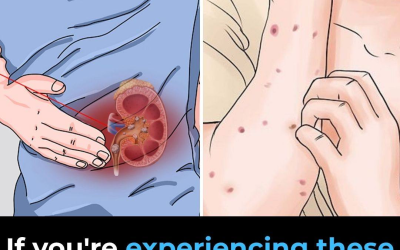 How to recognize early kidney disease signs and protect your kidney health