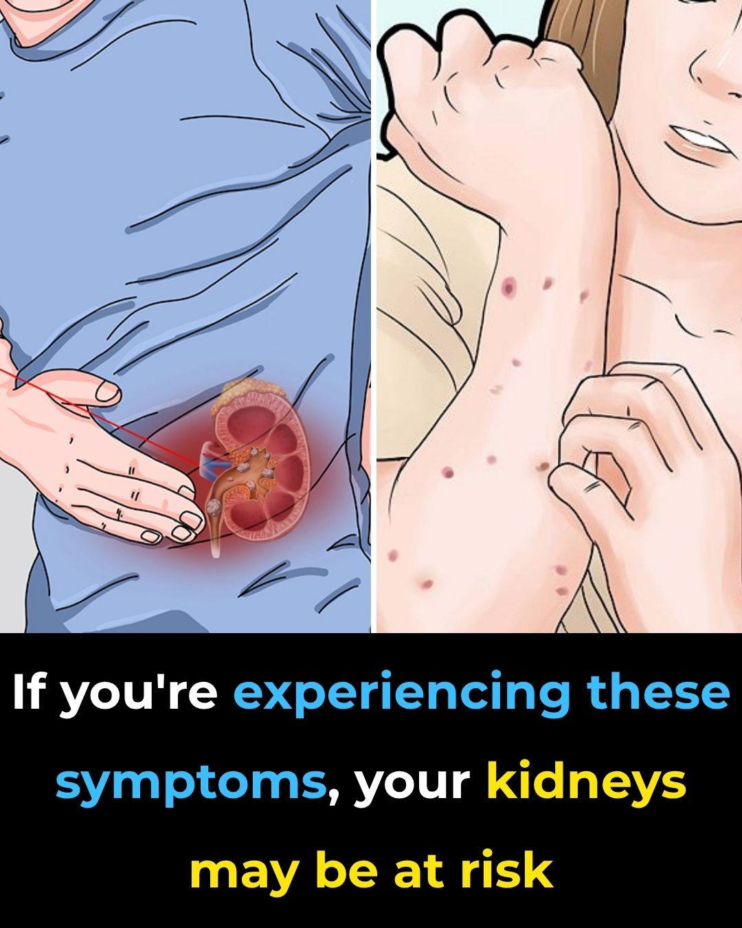 How to recognize early kidney disease signs and protect your kidney health