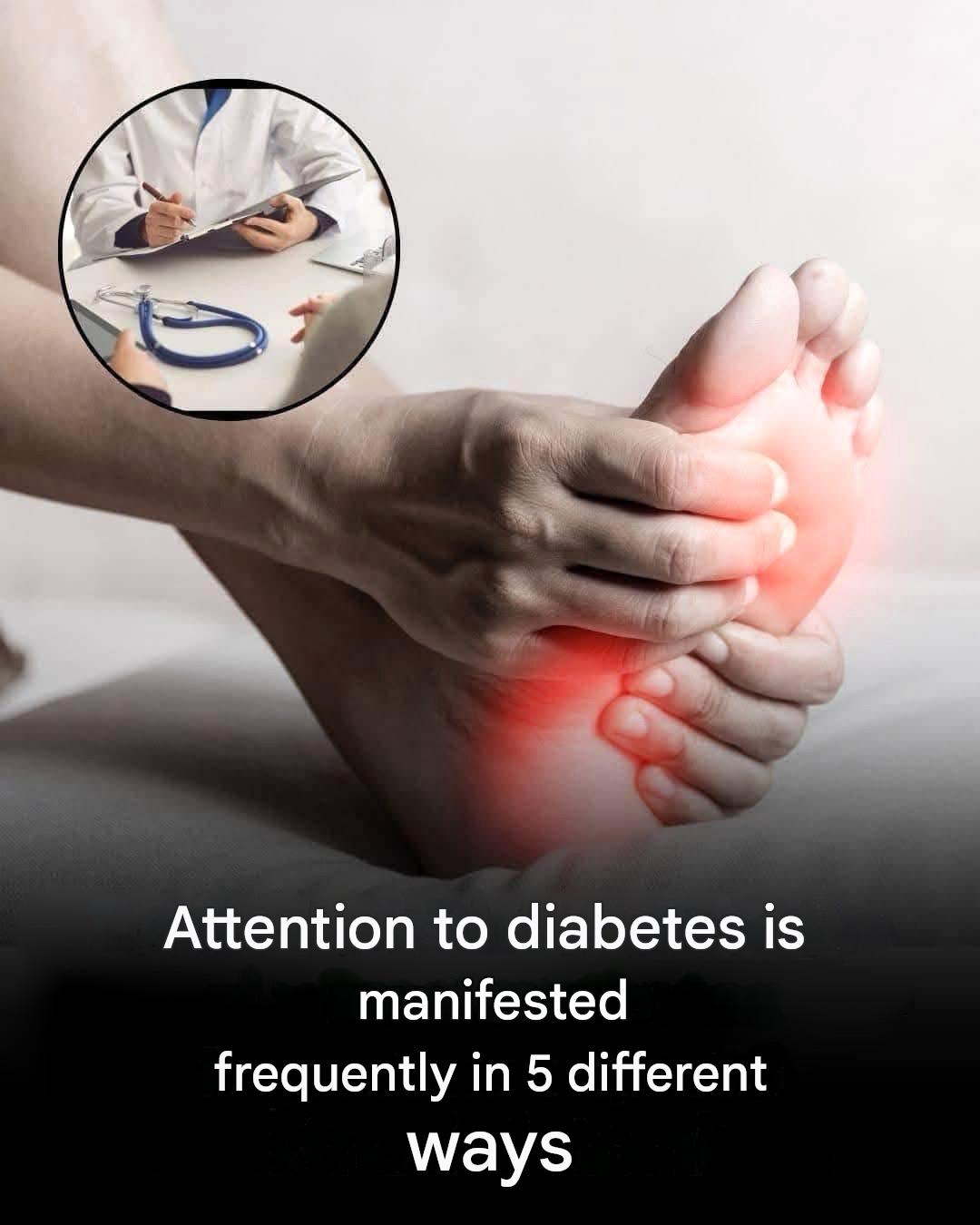 Symptoms of high blood sugar