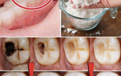 Smart Habits to Protect Your Teeth