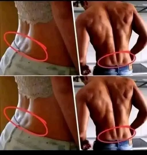What It Means If You Have Two Dimples on Your Lower Back