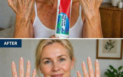 Could A Simple Kitchen Ingredient Like This Help Fade Wrinkles And Dark Spots On Your Hands And Arms?