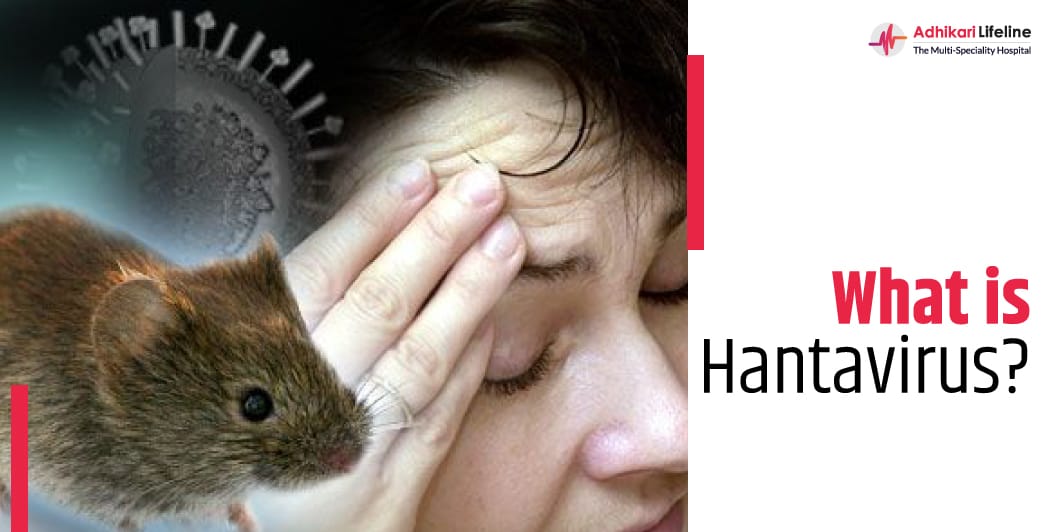 Hantavirus Pulmonary Syndrome