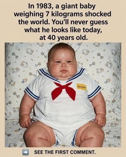The 7 kilo baby who amazed the world in 1983: this is how it looks today, at the age of 40.