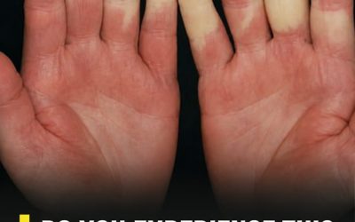 Do your fingers change color in the cold? It could be more serious than you think…..See more