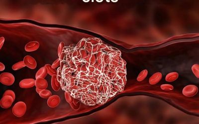 Blood circulation: these are the foods to eat every day to prevent blood clots