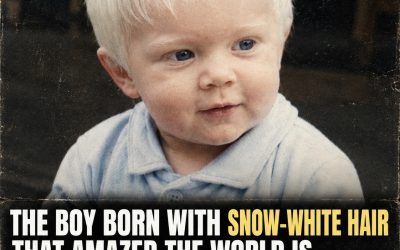 The Boy Born With Snow-White Hair – His Life Today
